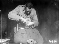 Dental extraction during First World War