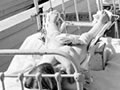Child with Polio