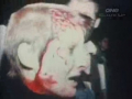 Film:  clash on Molesworth St - 1981 Springbok tour